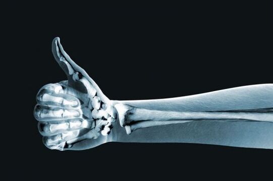 Radiografía para diagnosticar dor nas articulacións dos dedos