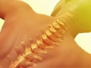 osteocondrosis - enfermidade da columna vertebral